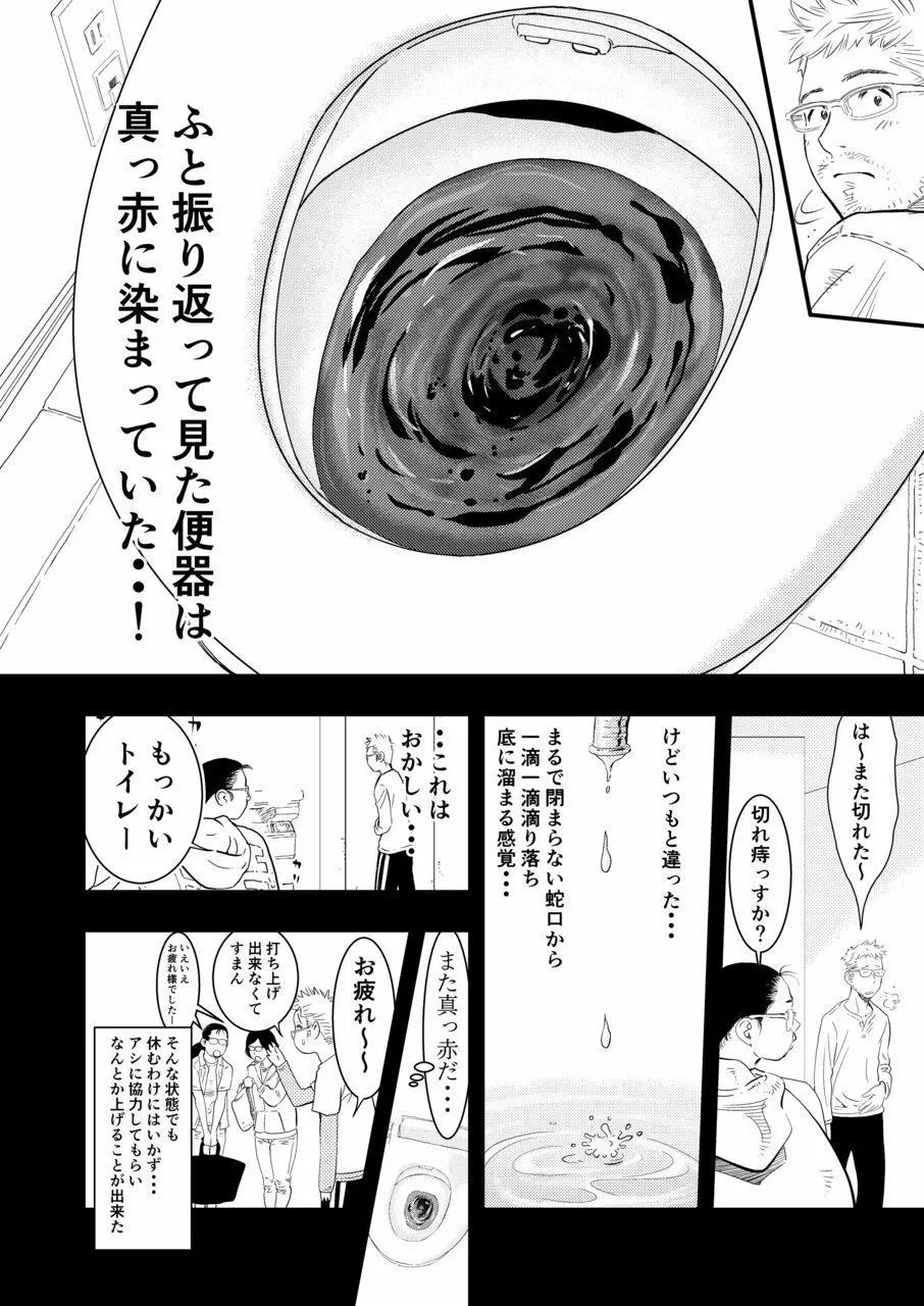 癌と女装とふくらむオッパイ1 - page11