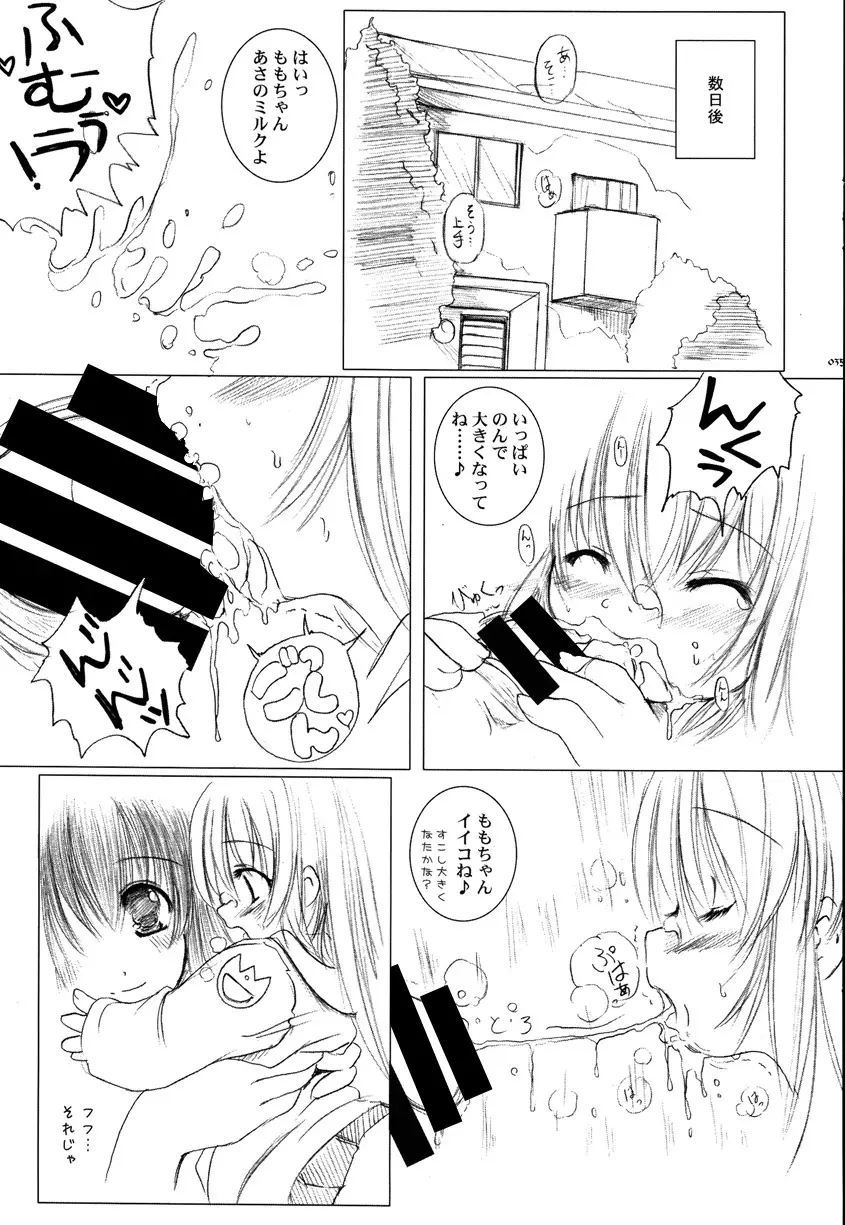 欠損少女Memories1 - page34